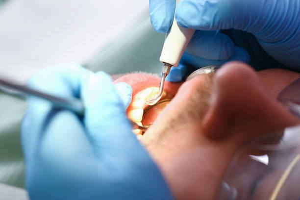 Best Emergency Care for Gum Disease in North Pearsall, TX