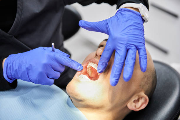Best Emergency Wisdom Tooth Extraction in North Pearsall, TX